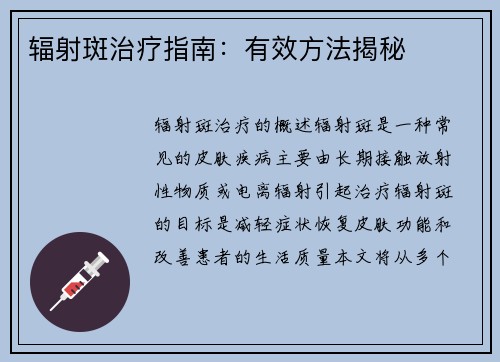 辐射斑治疗指南：有效方法揭秘
